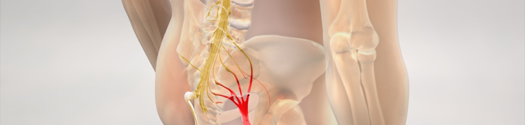 Sciatica: A Comprehensive Guide to Understanding & Relieving Your Pain